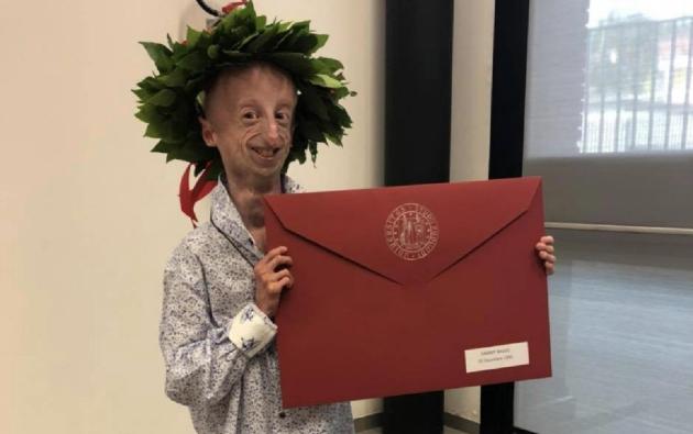 Sammy Basso: fidanzata, quanto può vivere, malattia, laurea, genitori ed età 