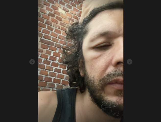 Ermal Meta, i concerti annullati e le nuove date: come chiedere il rimborso