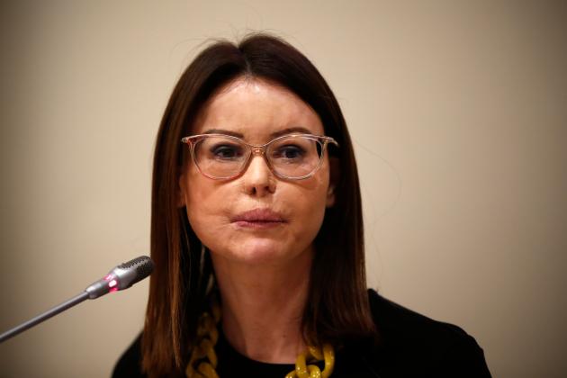 Lucia Annibali sfregiata con l’acido, libero uno dei sicari albanesi grazie a uno sconto di pena: “Non ho paura di lui, ma del mio ex”
