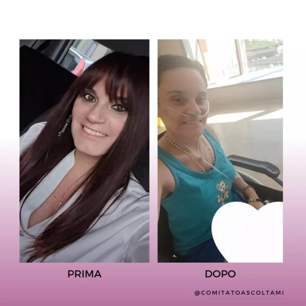Vaccino Covid Pfizer, effetti avversi su Rita, 36 anni: “Vie aeree ostruite dopo 2 dosi, ossigeno a vita”