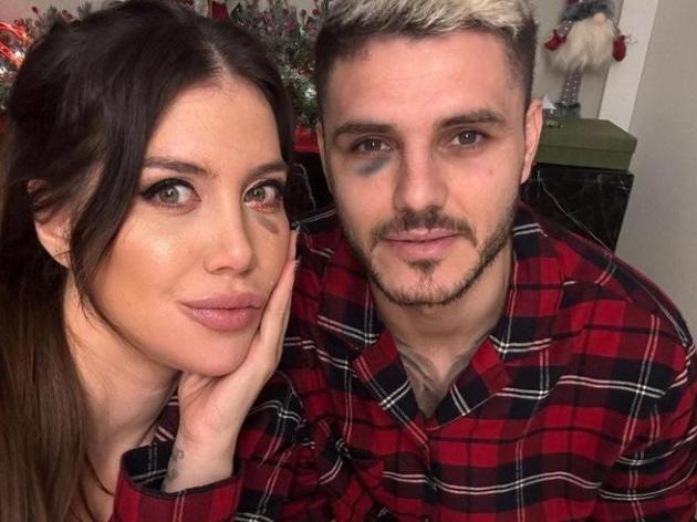 Icardi occhio nero nel derby di Istanbul e rissa social con l'avversario Dzeko