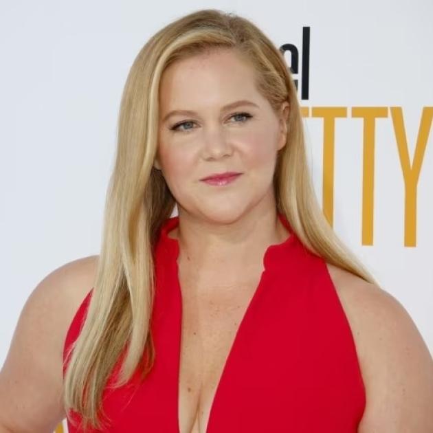 L'attrice Amy Schumer: "Ho la sindrome di Cushing, da qui il viso gonfio", la causa è l’eccesso dell'ormone cortisolo