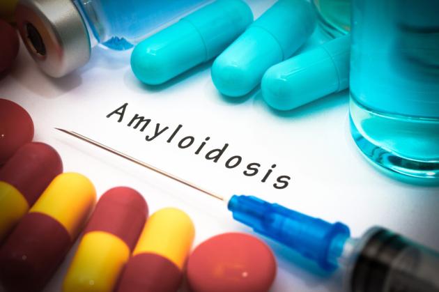 Amiloidosi
