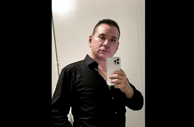 Jose Lizarraga Picciotti, chi è il chirurgo plastico e ristoratore indagato per la morte di una paziente dopo la liposuzione