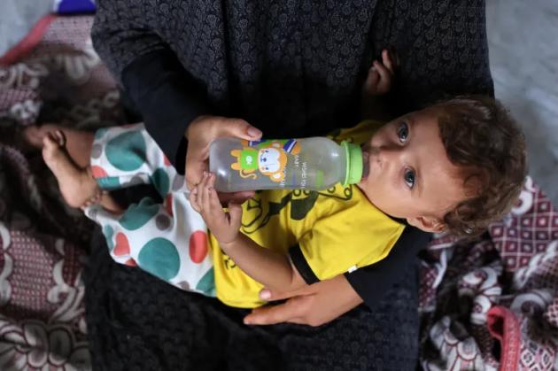 "A Gaza ogni bambino sotto i 5 anni è a rischio malnutrizione", la denuncia dell'Onu contro il blocco degli aiuti imposto da Israele