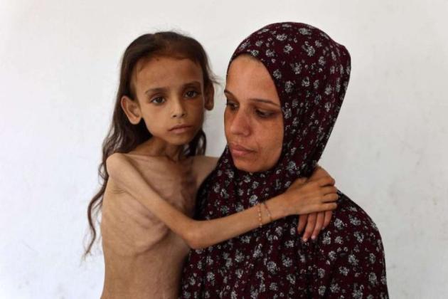 Gaza, aumentano le vittime dovute alla carestia causata da Israele, ministro Salute palestinese: "289 morti per fame tra cui 115 bambini"