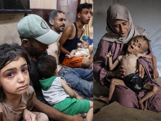 Gaza, Muhammad Zakariya Ayyoub al-Matouq ridotto a pelle e ossa causa carestia: ha 1 anno e mezzo e pesa 6kg, come un bambino di 3 mesi