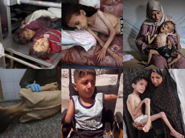 World Press Photo 2025, il vincitore è lo scatto di un bambino di Gaza amputato dopo raid di Israele, fatto da Samar Abu Elouf per raccontare la tragedia nella Striscia