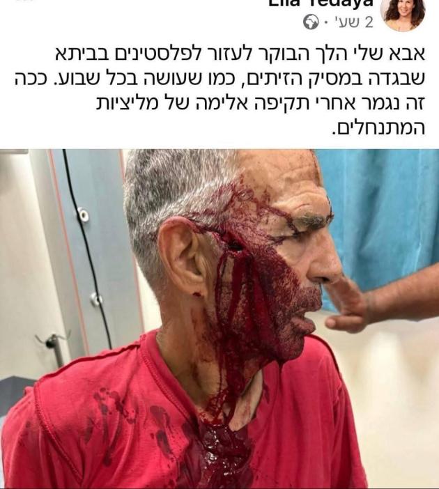 Cisgiordania, israeliana denuncia violenze Idf contro il padre "reo" di aver aiutato palestinesi in raccolta olive: "Gli hanno rotto lo zigomo"