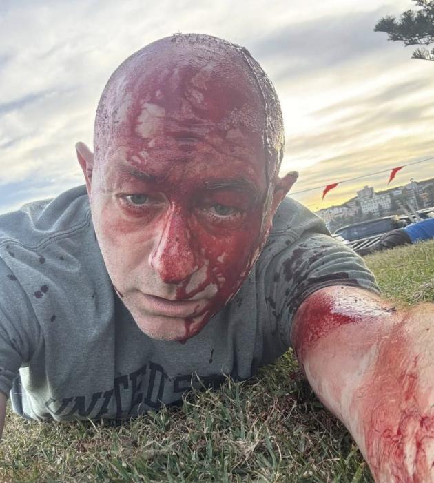 Attentato Sydney, sul posto Arsen Ostrovosky &ldquo;usato da Israele per propaganda&rdquo;, pubblicate foto con volto insanguinato, presente anche il 7 ottobre