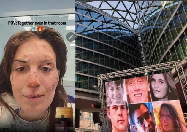 Crans Montana Niguarda, 15enne Elsa uscita dal coma,  16enni Leo e Kean comunicano tramite pc, 16enne Manfredi in attesa di intervento 