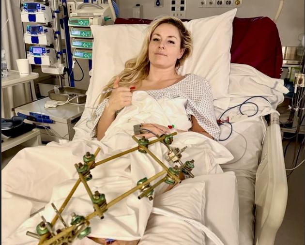 Lindsey Vonn, 4 operazioni in 6 giorni dopo caduta ad Olimpiadi Milano Cortina 2026, in Italia interventi gratuiti, in Usa costo ~$250mila