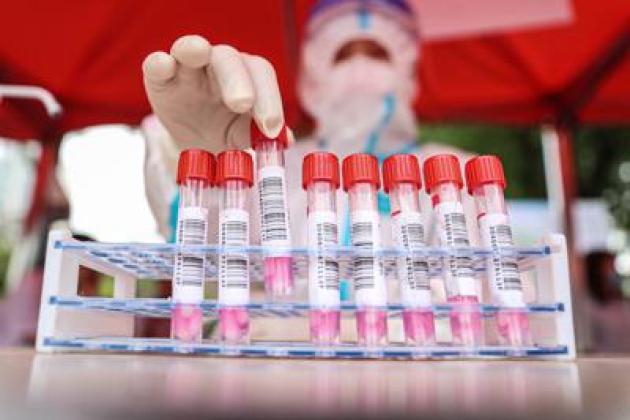 Variante Xe, il presidente dei virologi: "Zero dati in Italia"