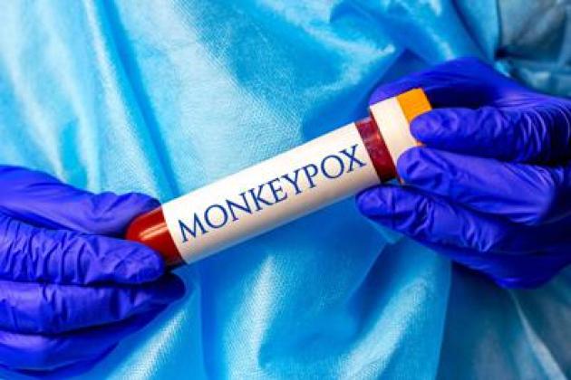 Vaiolo delle scimmie (Mpox), Oms lancia l’allarmismo e lo stato d’emergenza mondiale per 14mila casi, solo 9 in Italia