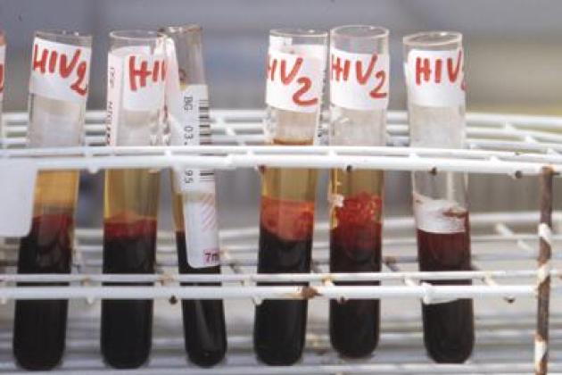 Aids: da virus mortale a farmaco, un libro racconta i 2 volti dell'Hiv