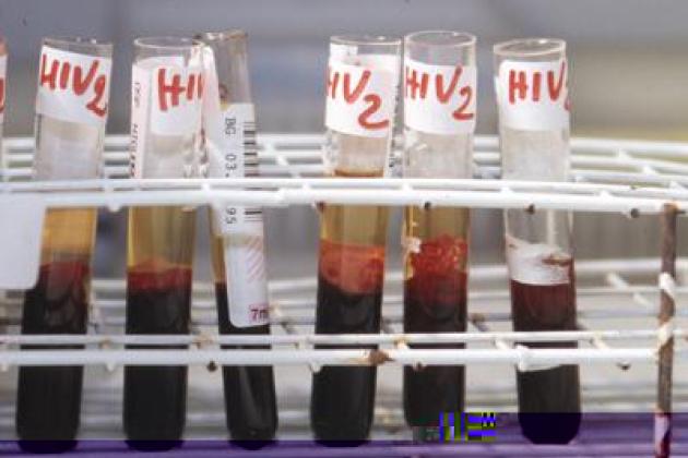 Aids, scoperti 'codici' del sistema immunitario per sospendere le cure