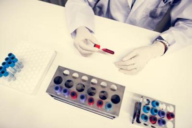 Cancro alla vescica, recidiva ridotta del 32% con immunoterapia durvalumab: lo studio