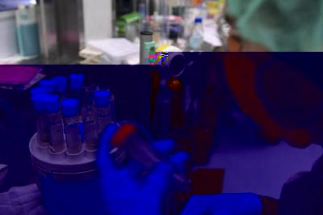 Legionella, il batterio che ama tubature e condizionatori: casi in aumento in Italia