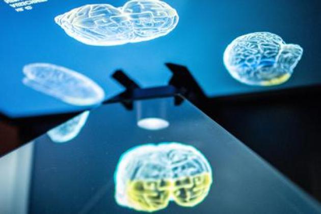 Tagliare le calorie può rallentare l'invecchiamento del cervello: ecco cosa dice lo studio