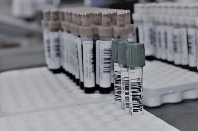 Coronavirus, Russia: primo lotto vaccino inviato a regioni