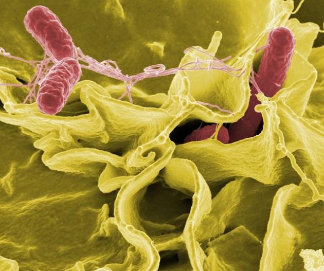 Cina, fuga di batteri da un laboratorio: tremila persone affette da brucellosi