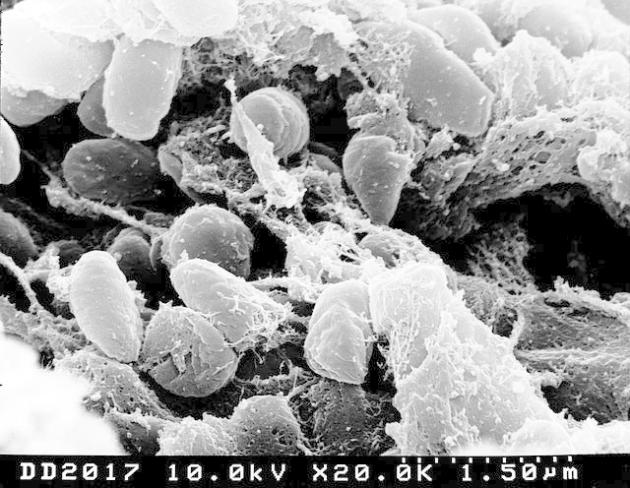 Cina, un caso di peste bubbonica: ecco cos'è e come si trasmette