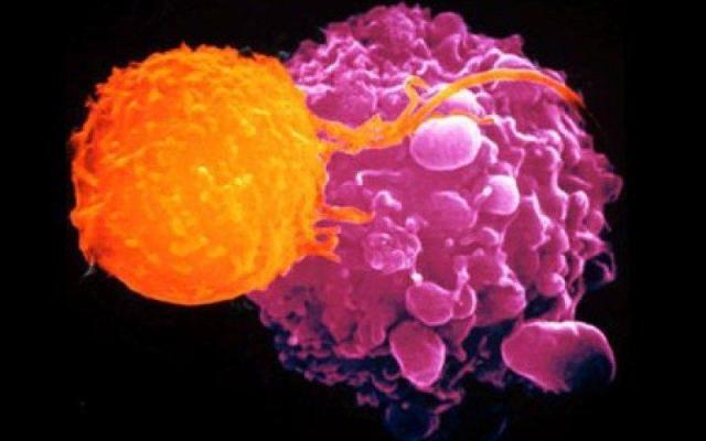 Scoperto un nuovo meccanismo per "affamare" i tumori