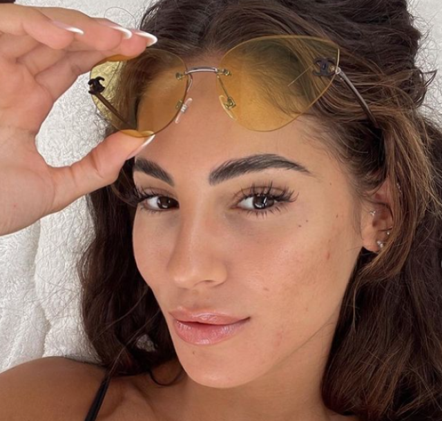 Giulia De Lellis acne incontrollabile, ma ora ha trovato la vera cura. Annuncio sui social