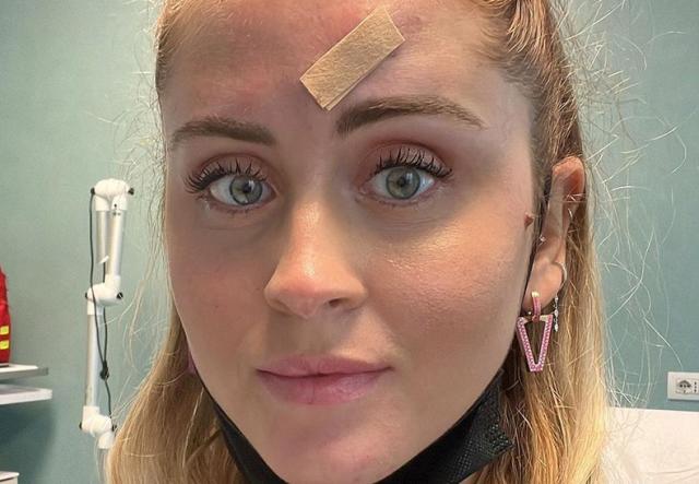 Valentina Ferragni in ospedale, ma nessuna malattia: solo un un brufolo "sospetto"