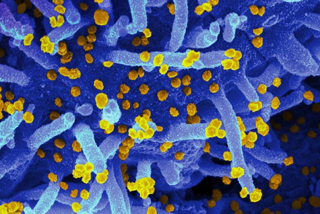 Covid, individuato meccanismo che blocca l'infezione: merito di un team italiano