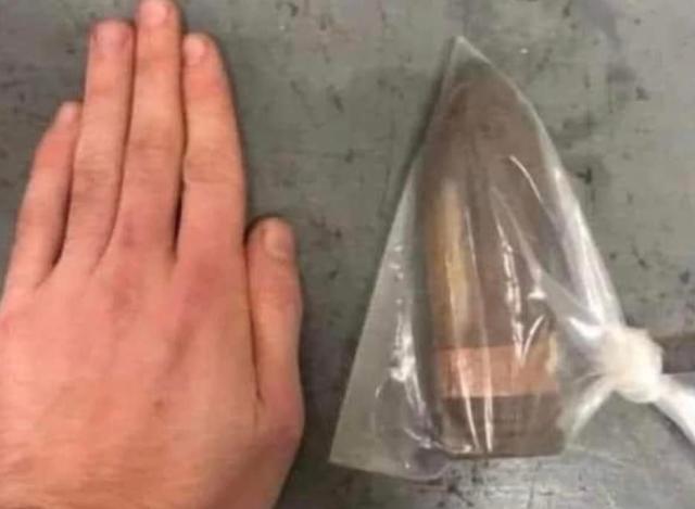 Proiettile da 17 centimetri nel sedere: uomo al pronto soccorso scatena il panico 