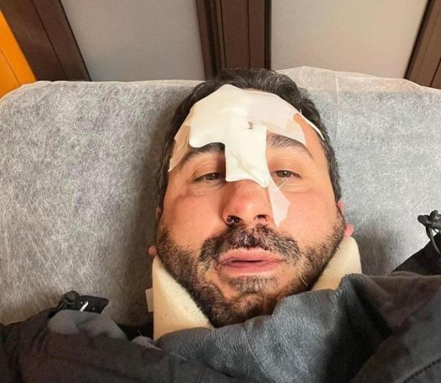 Natale Giunta, brutto incidente per lo chef de La Prova del Cuoco