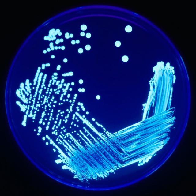 Cos'&egrave; la legionella: sintomi, malattia, si muore, trasmissione, polmonite, sistema immunitario