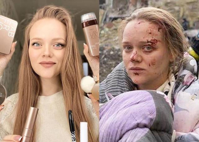 Chi &egrave; Marianna Podgurskaya, la blogger incinta simbolo dell'attacco all'ospedale di Mariupol