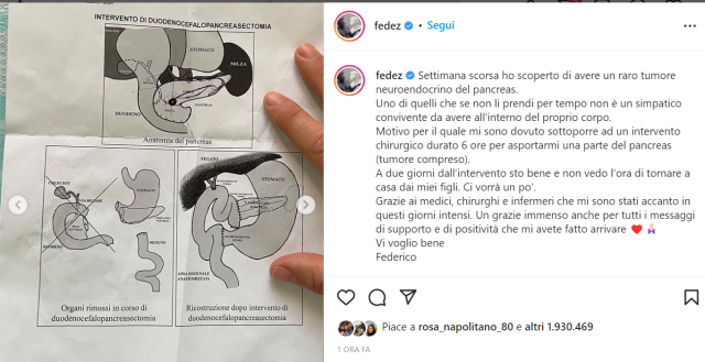 Tumore al pancreas, cos'&egrave; la malattia di Fedez: sintomi iniziali, quanto si vive, come si muore