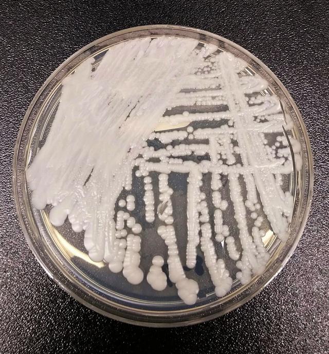Candida Auris, il fungo killer si diffonde nel mondo: &egrave; letale dal 30% al 70%