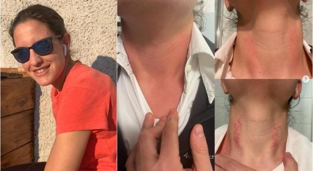 Adelaide Andriani, la specializzanda aggredita a Udine lascia la professione medica