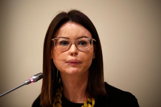 Lucia Annibali sfregiata con l&rsquo;acido, libero uno dei sicari albanesi grazie a uno sconto di pena: &ldquo;Non ho paura di lui, ma del mio ex&rdquo;