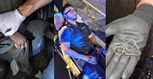 Catania, poliziotto colpito alla gola da extracomunitario: &ldquo;mancata di poco la giugulare, vivo per miracolo&rdquo;