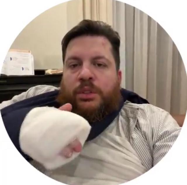Lituania, il braccio destro di Navalny Leonid Volkov colpito a martellate davanti a casa, lui: "Non ci arrenderemo"