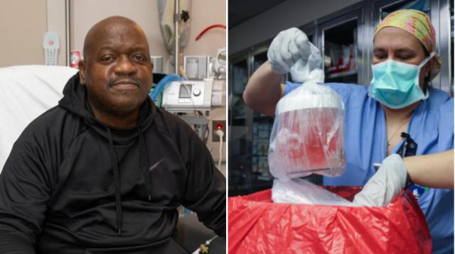 Richard Slayman, morto l'uomo con un rene di maiale 2 mesi dopo il trapianto: affetto da malattia renale allo stadio terminale, aveva 62 anni