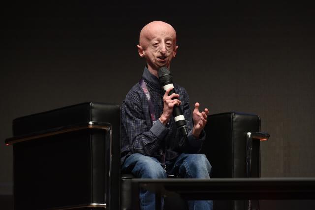 Addio Sammy Basso morto 28 anni malore improvviso ristorante malato progeria pi&ugrave; longevo al mondo