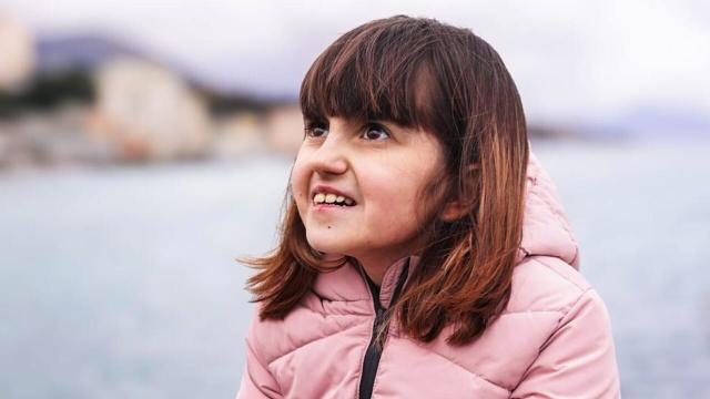 Nubpl, cos'&egrave; la mitocondriopatia geneticamente determinata: sintomi, aspettative di vita e causa della malattia di Elena Dellepiane