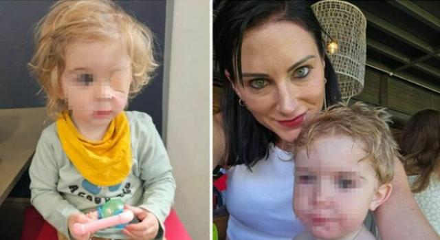 Bimbo diventa cieco a 2 anni