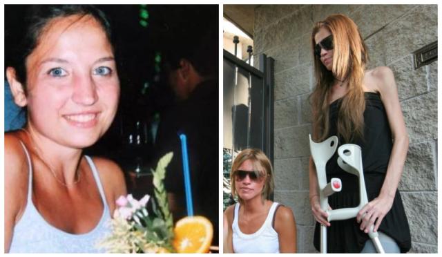 Omicidio di Chiara Poggi, trovato dna di Andrea Sempio e di "ignoto 2" attorno alle unghie della giovane