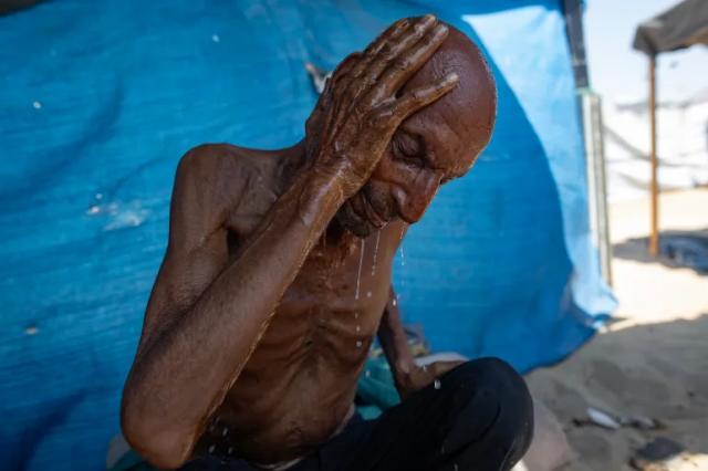 Gaza, palestinesi affamati da Israele, oltre 180 morti per fame, almeno 90 bambini: gli effetti della malnutrizione e dell'inedia sul corpo umano 