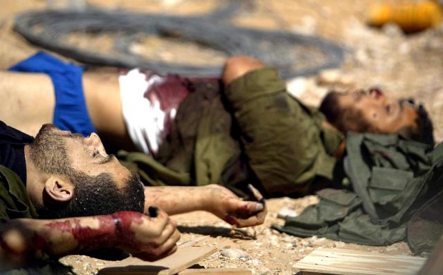 Estrazione sperma dai cadaveri dei soldati Idf, come funziona: entro 48 ore dalla morte incisione del testicolo, isolamento cellule spermatiche e congelamento