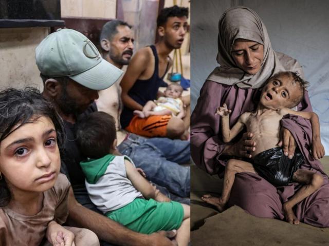 Gaza, Muhammad Zakariya Ayyoub al-Matouq ridotto a pelle e ossa causa carestia: ha 1 anno e mezzo e pesa 6kg, come un bambino di 3 mesi