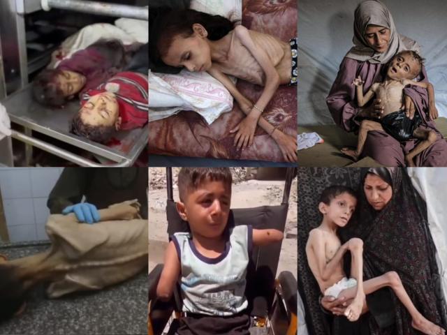 World Press Photo 2025, il vincitore &egrave; lo scatto di un bambino di Gaza amputato dopo raid di Israele, fatto da Samar Abu Elouf per raccontare la tragedia nella Striscia