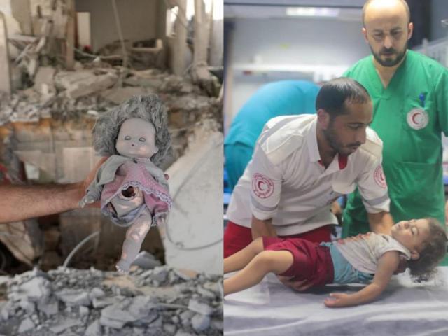 Gaza, i medici: "Operiamo senza anestesia, usiamo aceto al posto dell&rsquo;alcol. L'acqua? Devi scegliere se berla o usarla per lavarti"